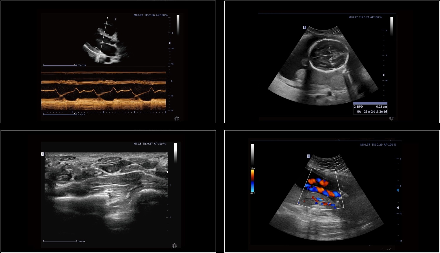 Снимок Focus Fusion Danus 30
