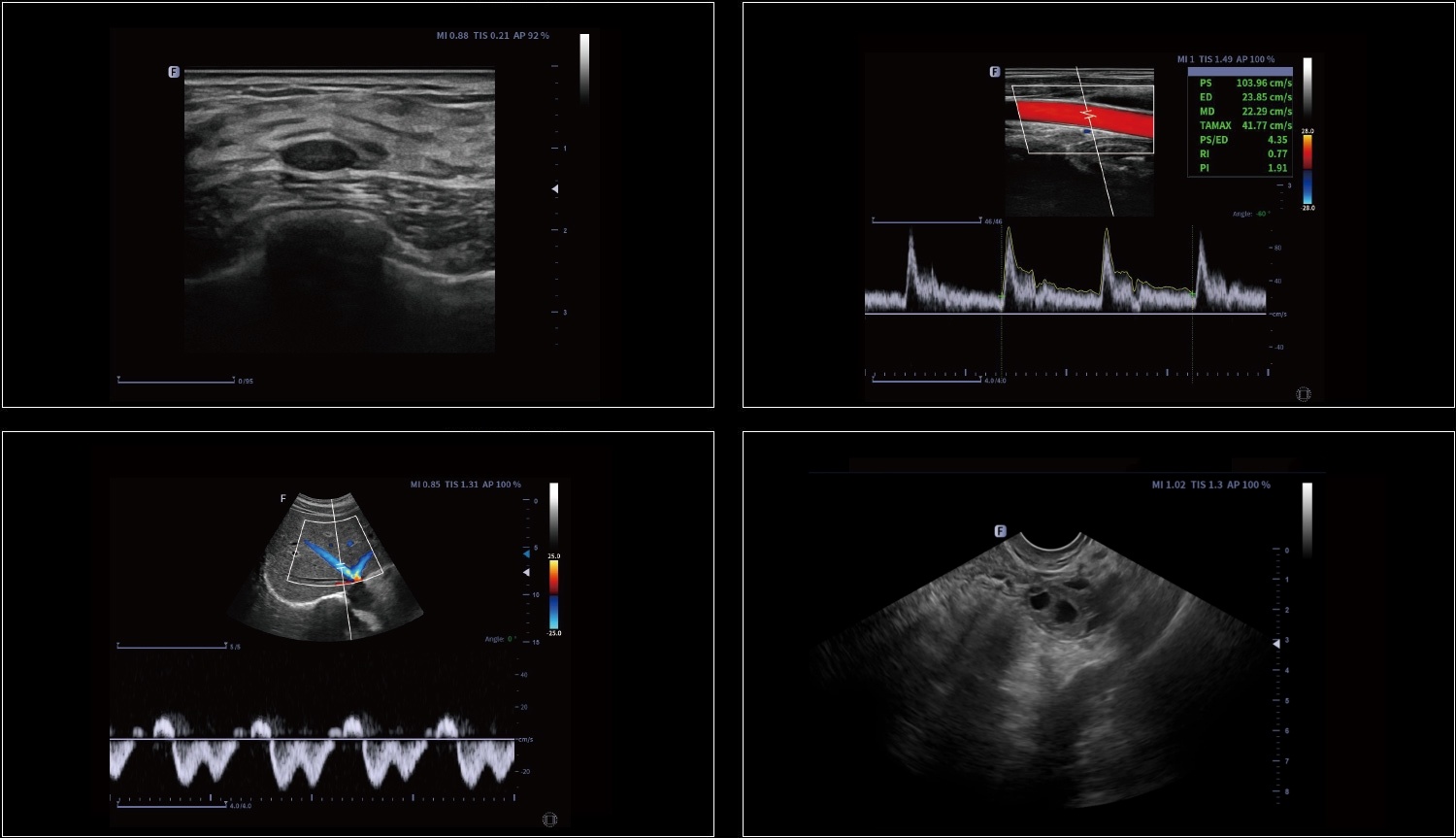 Снимок Focus Fusion Danus 30