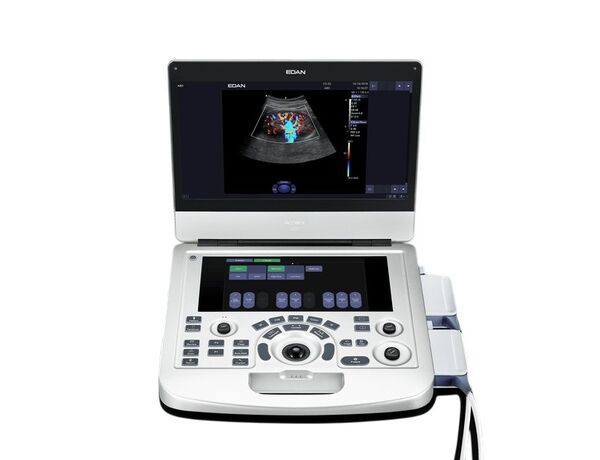 Acclarix AX3 — портативный УЗИ-аппарат