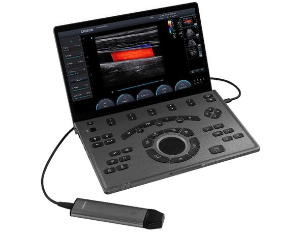 SonoAir — портативный ветеринарный УЗИ-аппарат с цветным доплером и 2 датчиками