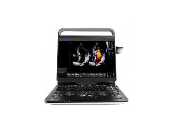 ST60 — портативный ветеринарный УЗИ-аппарат с 3 датчиками